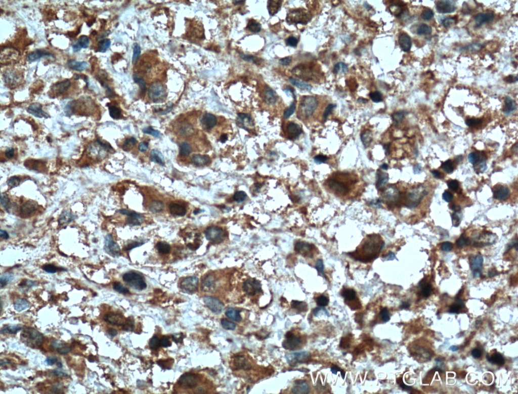 MMP2 Monoclonal antibody