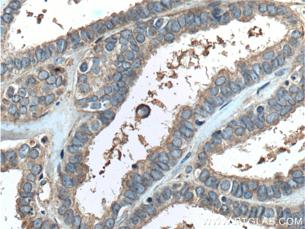 PGRMC1 Monoclonal antibody