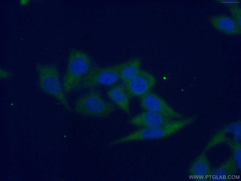 G6PD Monoclonal antibody