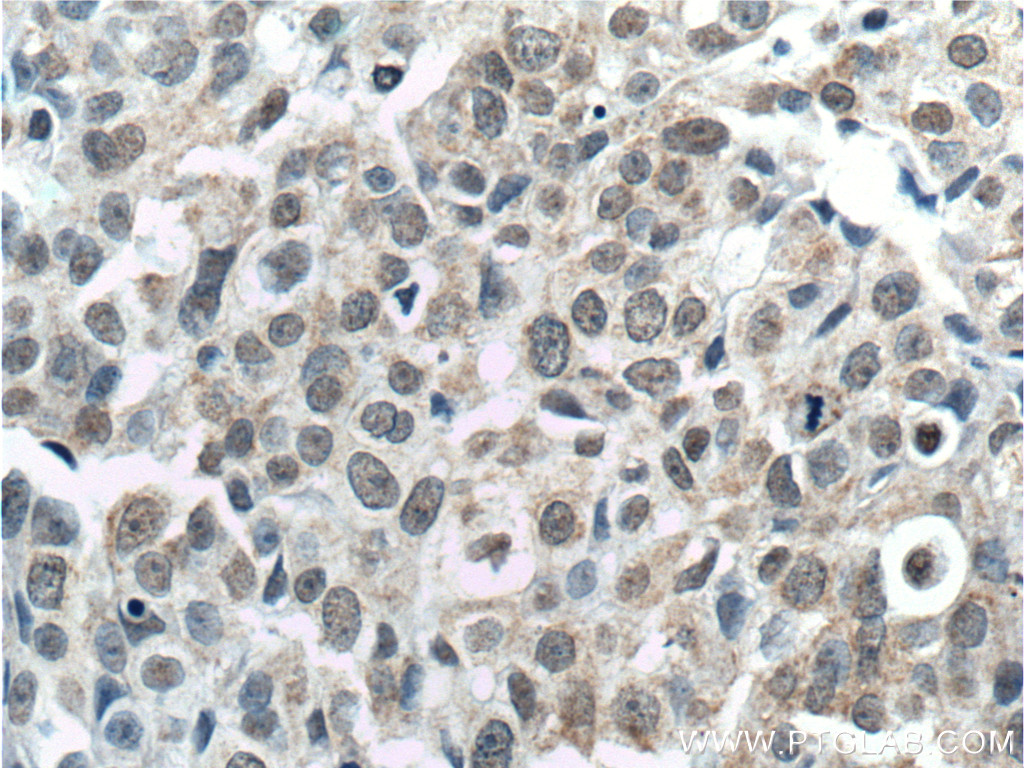 TINP1 Monoclonal antibody