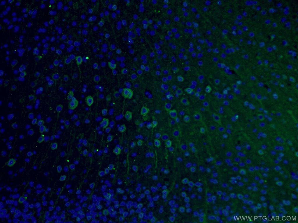TUBB3-specific Monoclonal antibody