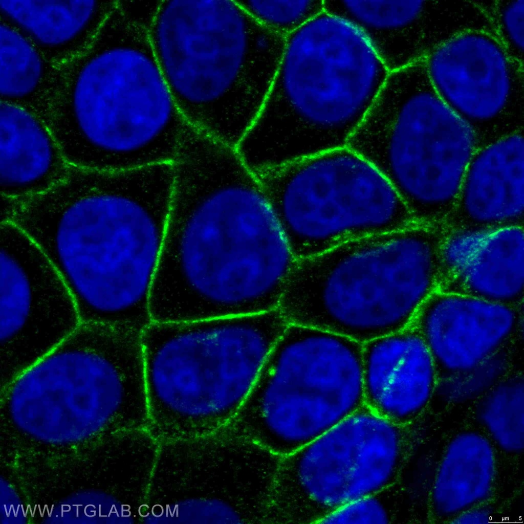 Beta Catenin Monoclonal antibody
