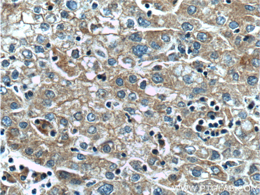 SLCO1B3 Monoclonal antibody