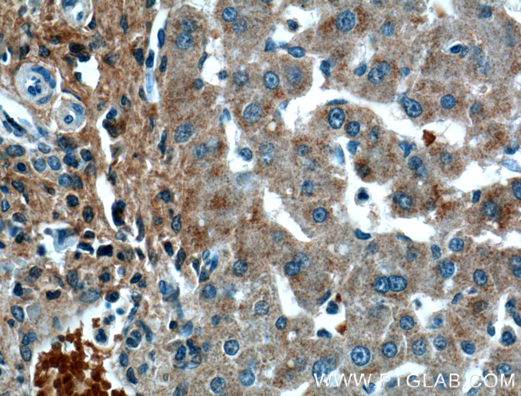 OGN Monoclonal antibody