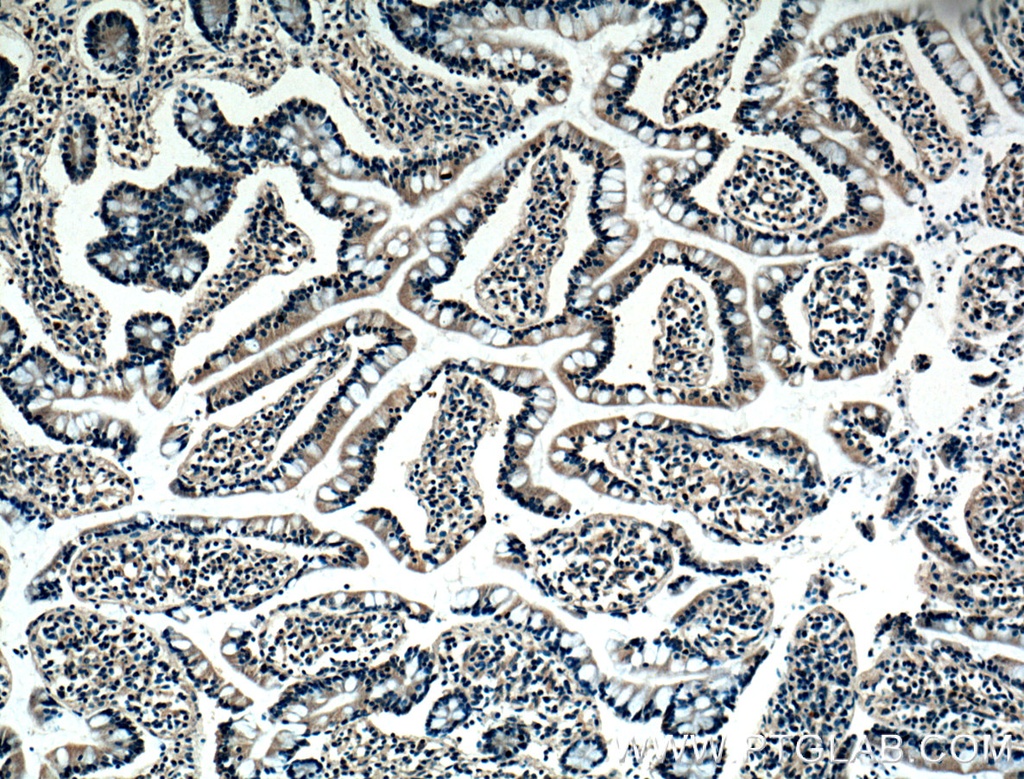 BMP2 Monoclonal antibody