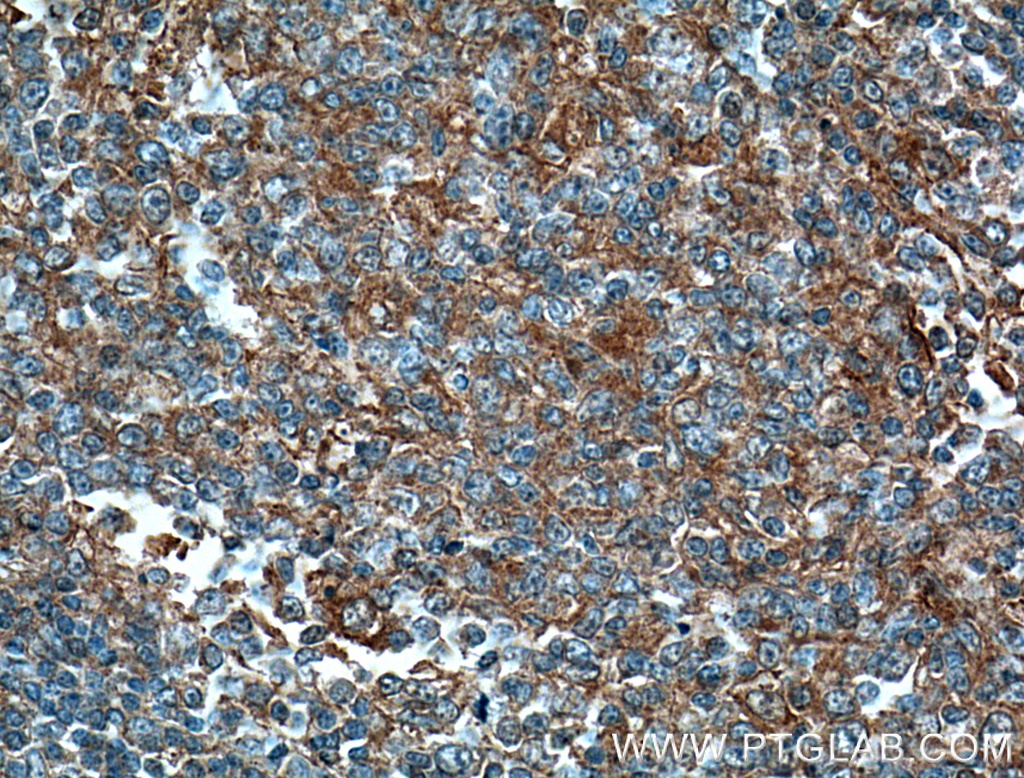 MICA Monoclonal antibody