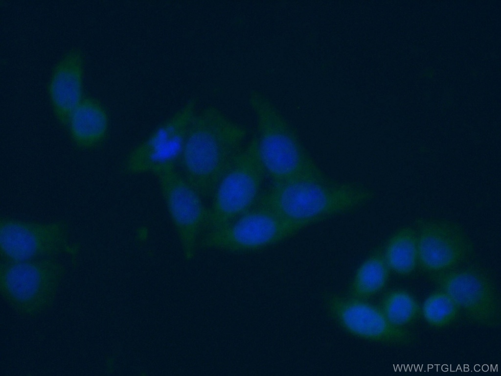 NAMPT/PBEF Monoclonal antibody