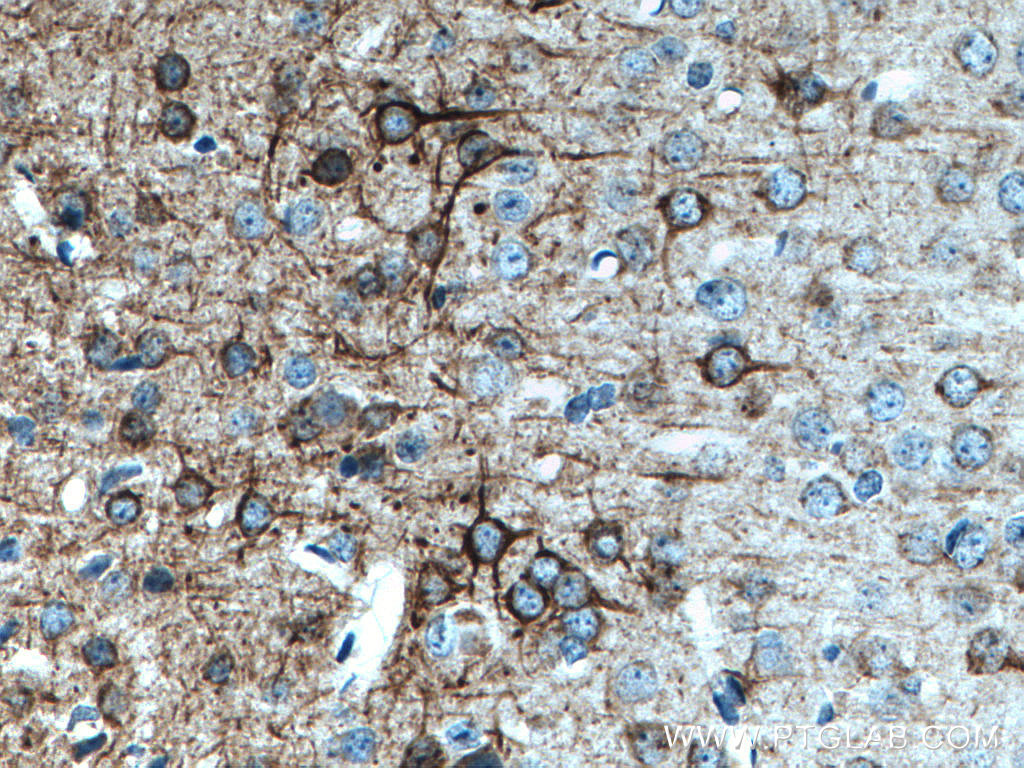 NF-M Monoclonal antibody