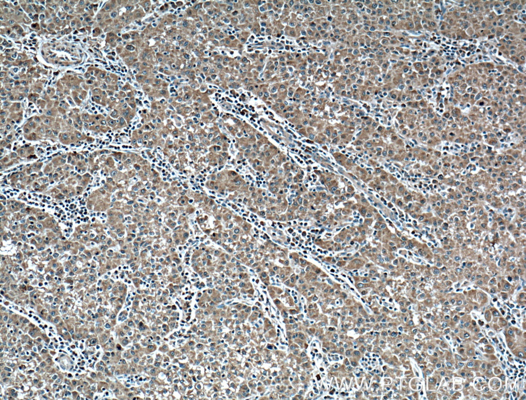 Plasminogen Monoclonal antibody