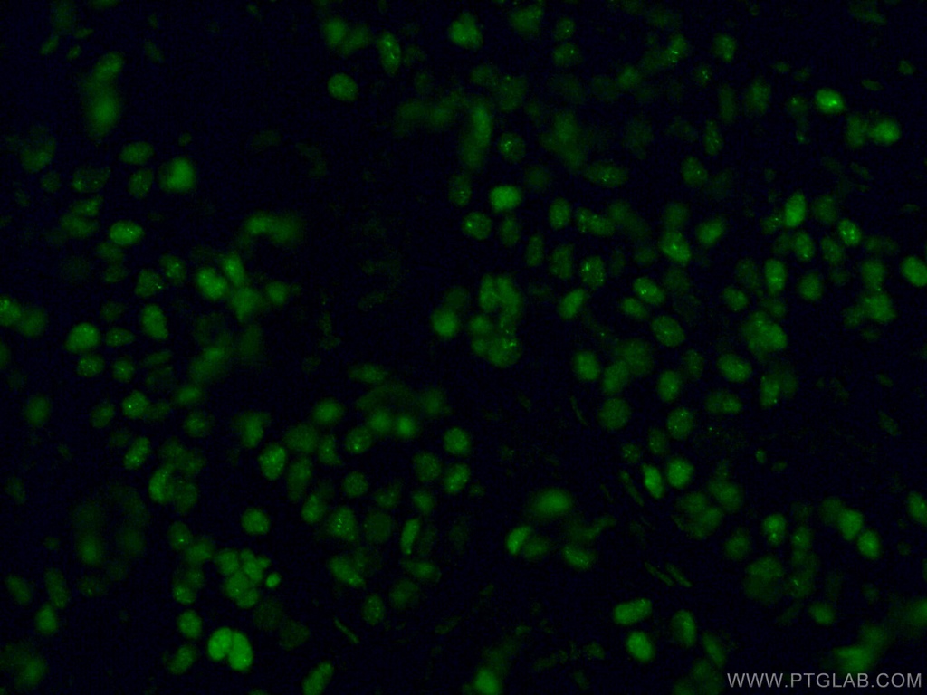 GATA3 Monoclonal antibody