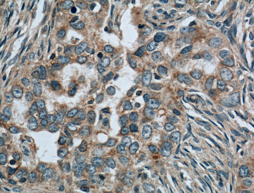 CALCOCO2 Monoclonal antibody