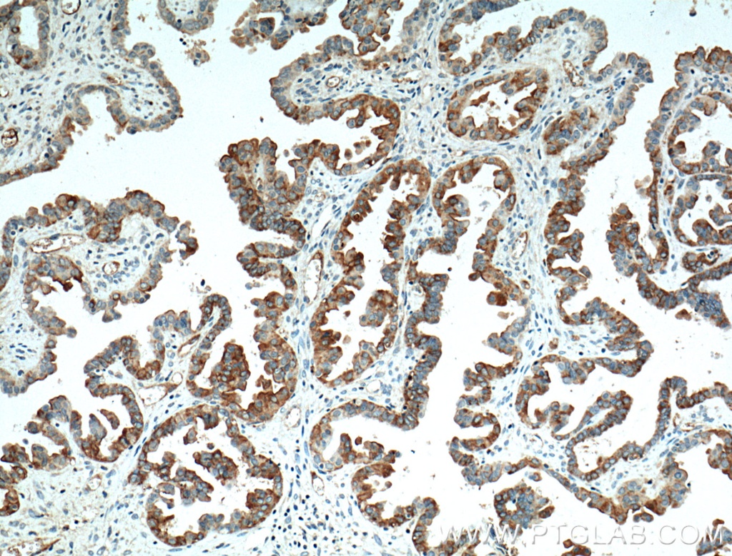 Mesothelin Monoclonal antibody