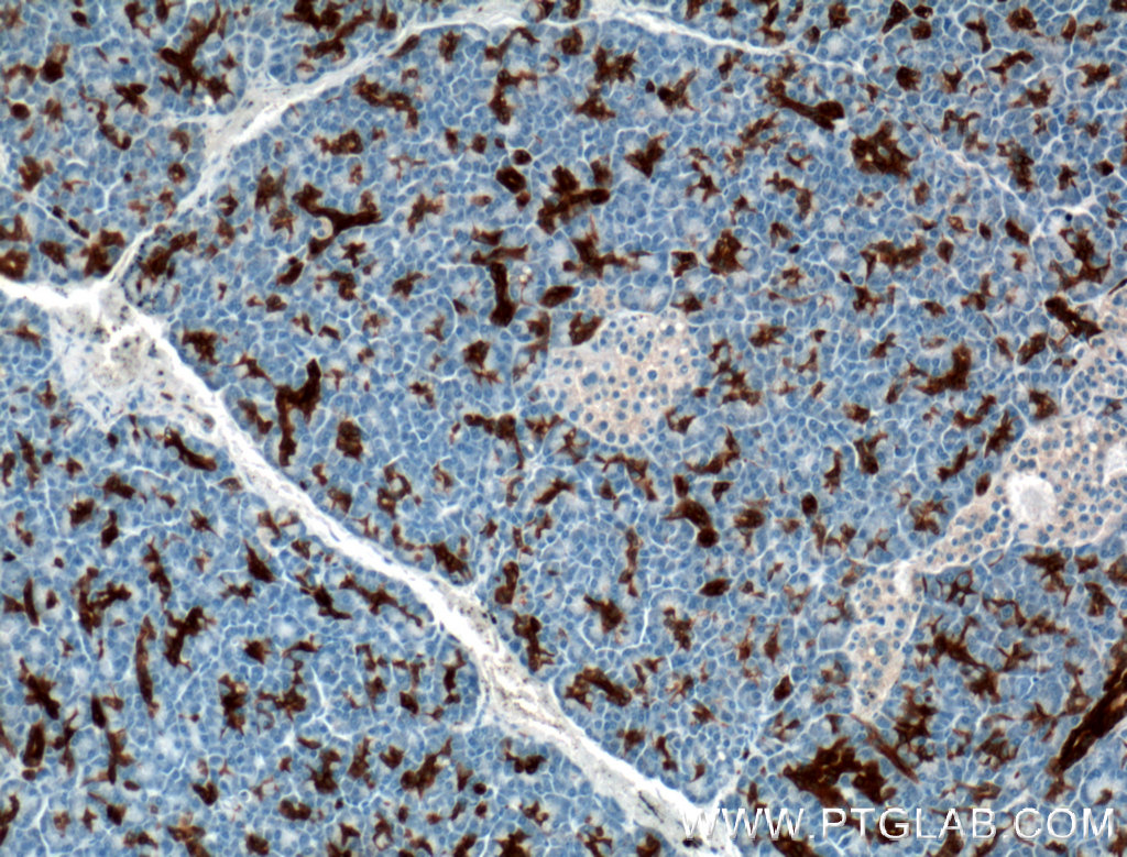 Annexin A3 Monoclonal antibody