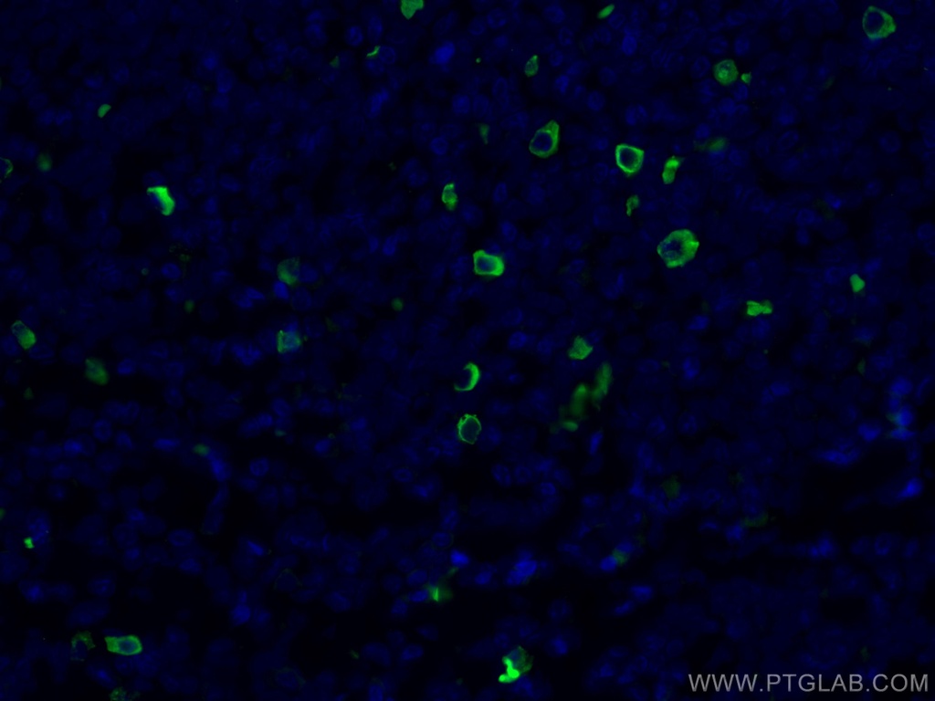 Human IgG4 Monoclonal antibody