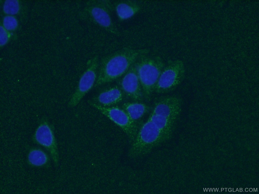 SIRT2 Monoclonal antibody