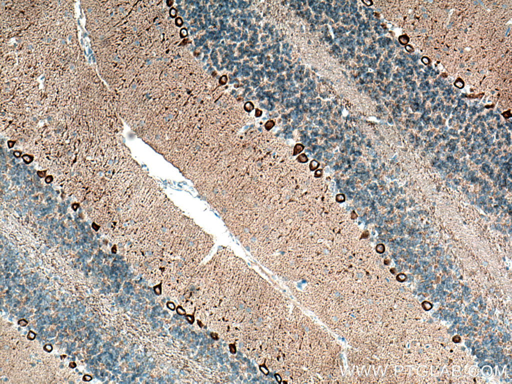 Alpha Synuclein Monoclonal antibody