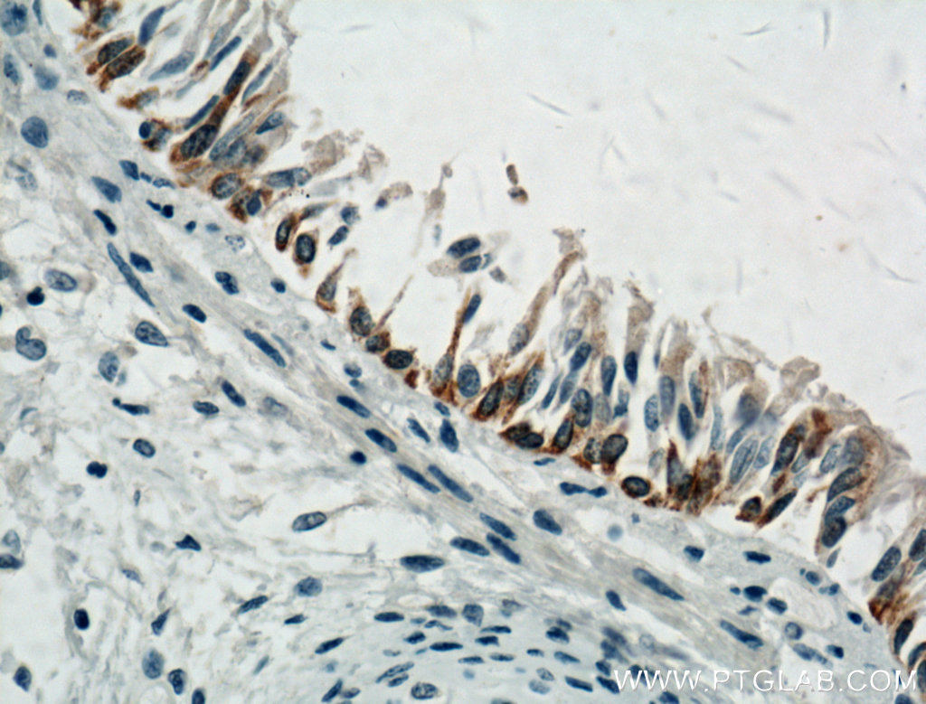 LAP3 Monoclonal antibody