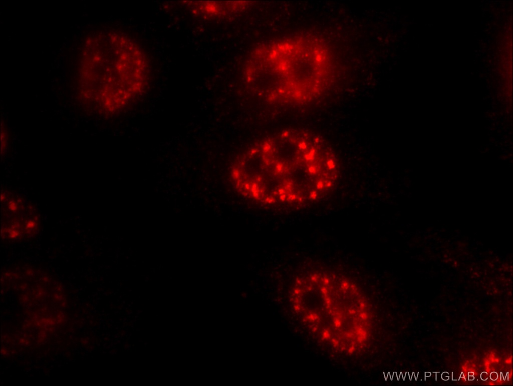 FOXO3A Monoclonal antibody