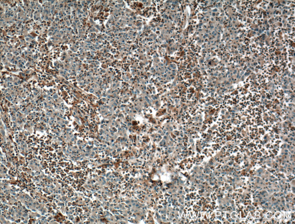 PLEK Monoclonal antibody