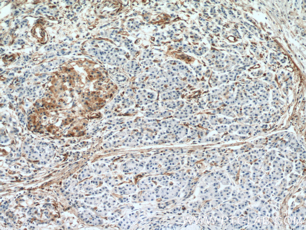 Amphiregulin Monoclonal antibody