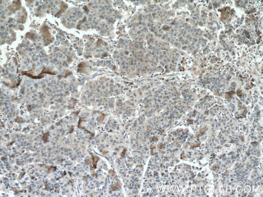 PEBP1 Monoclonal antibody