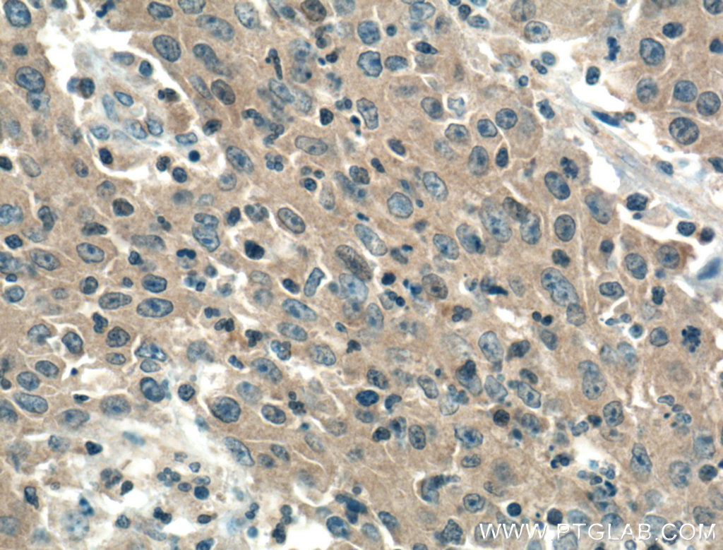 PDCD10 Monoclonal antibody