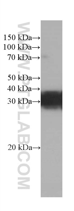 RGS4 Monoclonal antibody