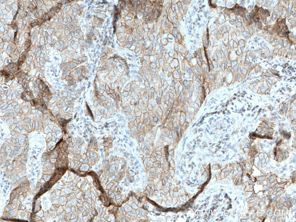 Gamma Catenin Monoclonal antibody
