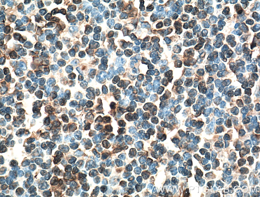 IRF4 Monoclonal antibody