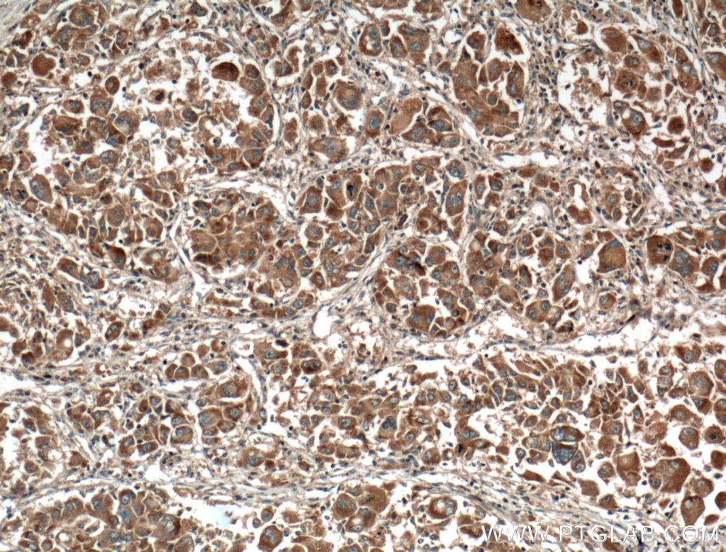 GNPAT Monoclonal antibody