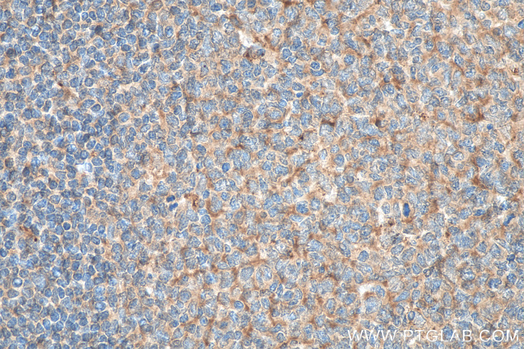 Lysozyme Monoclonal antibody