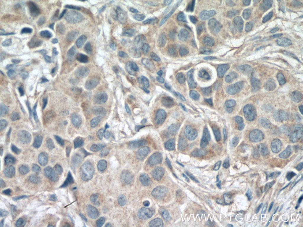 IKBKG Monoclonal antibody
