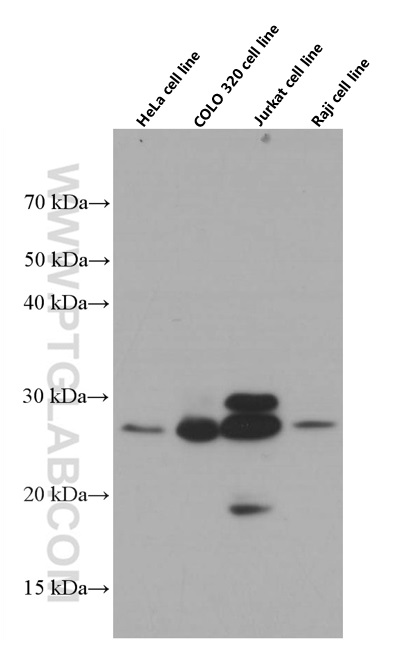 OIP5 Monoclonal antibody