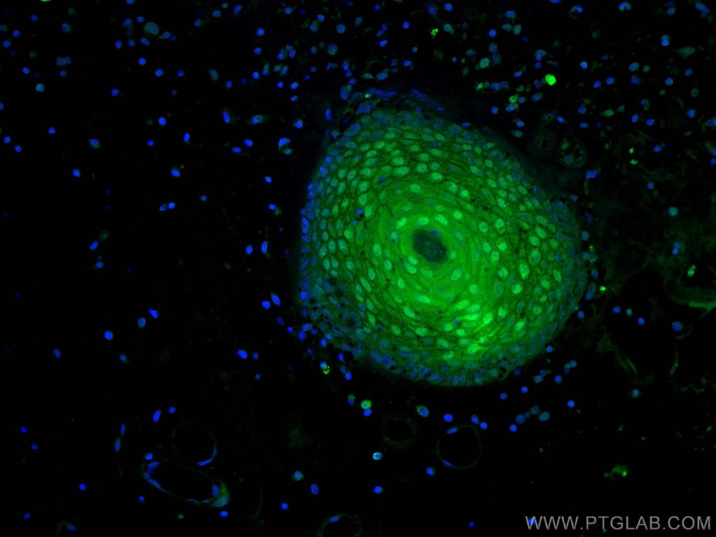 CRABP2 Monoclonal antibody