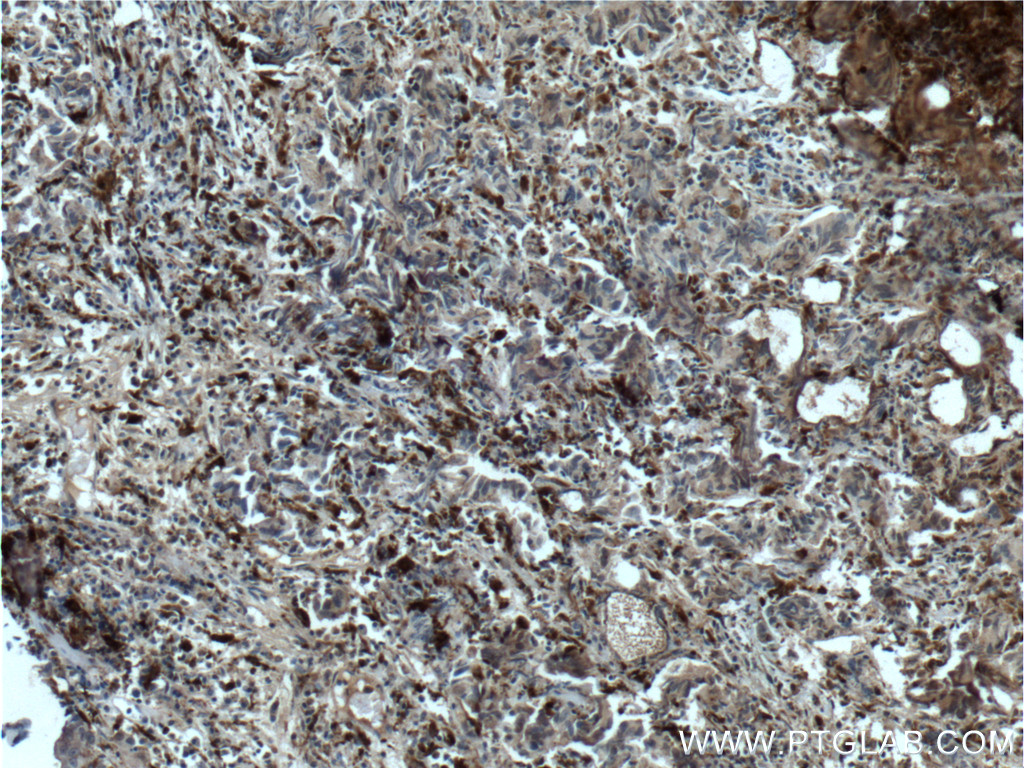 PSAP Monoclonal antibody