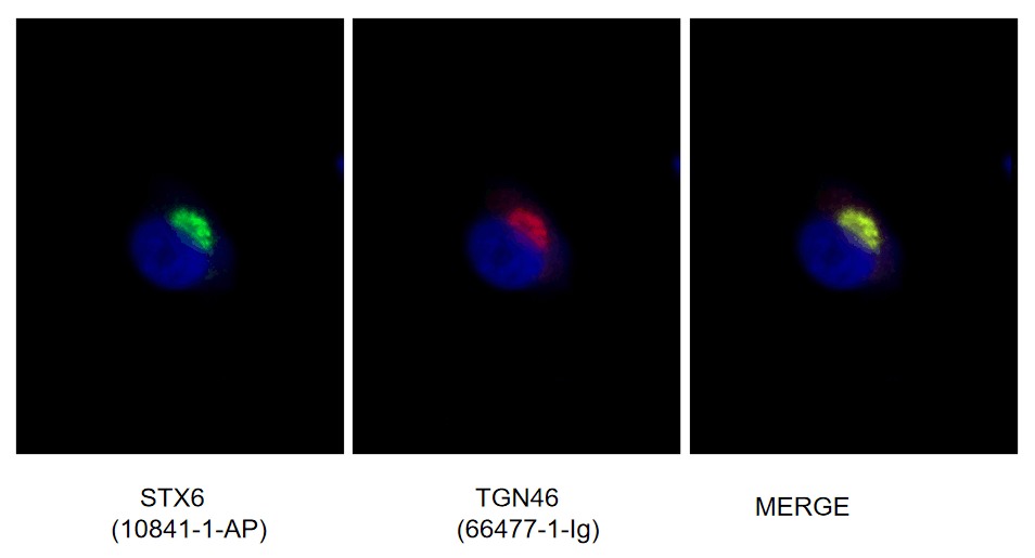 TGN46 Monoclonal antibody