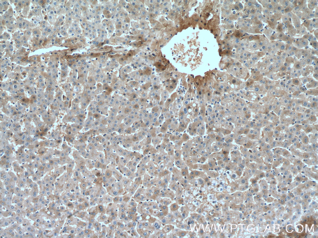 Hemopexin Monoclonal antibody