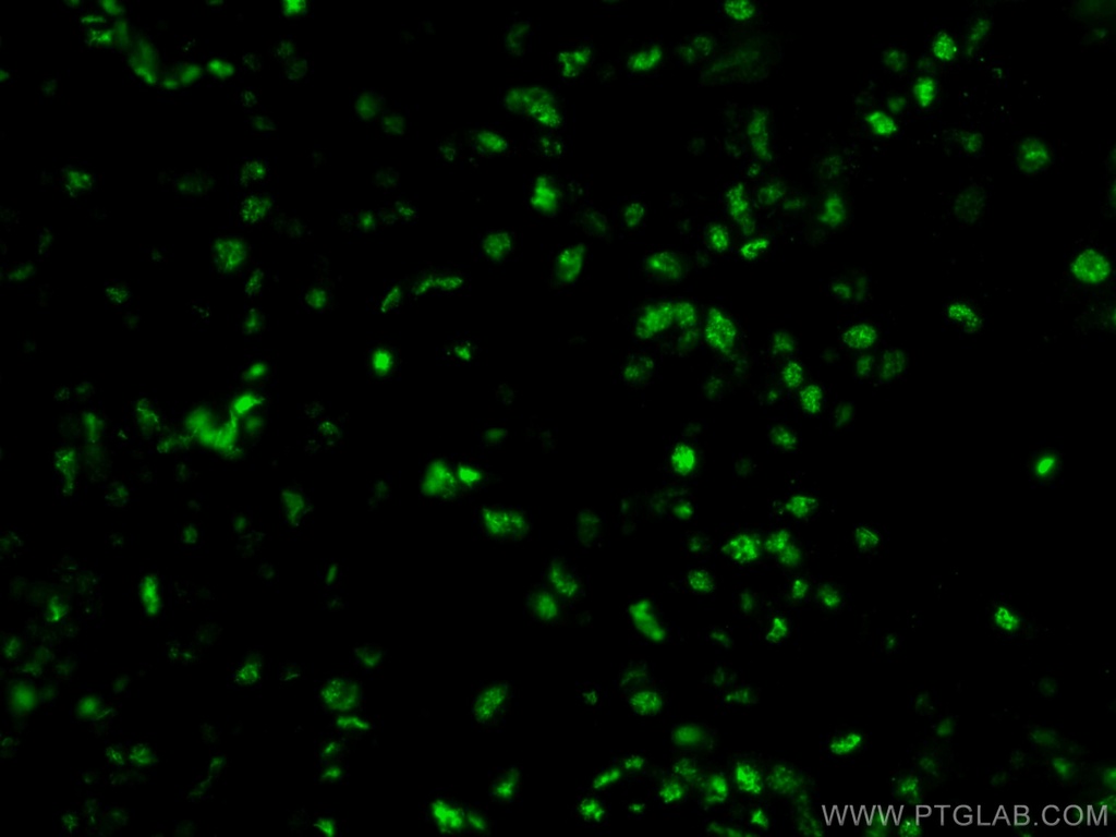 HRPT2; CDC73 Monoclonal antibody