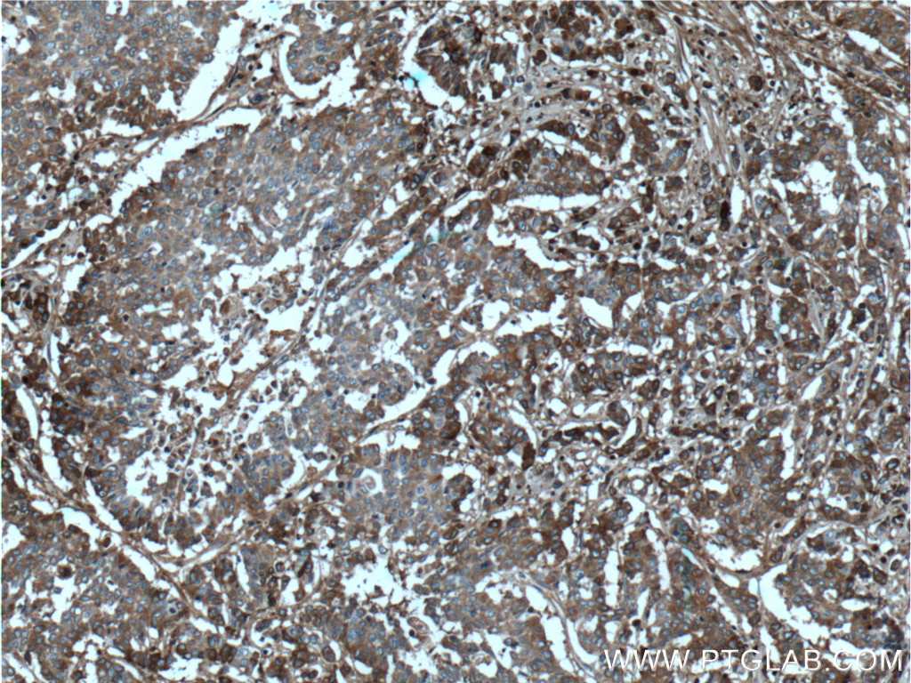 Periostin Monoclonal antibody