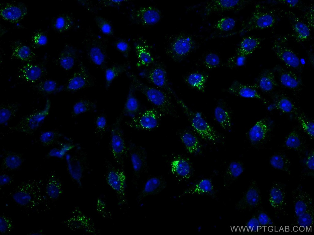 Calretinin Monoclonal antibody
