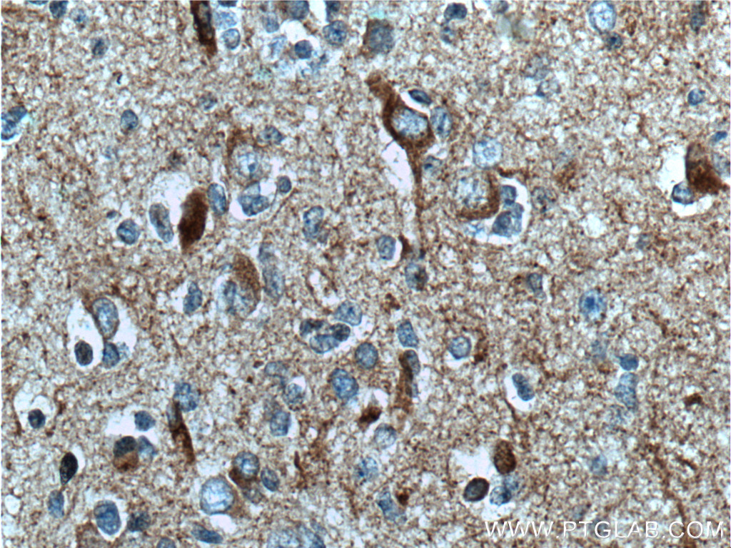 TAU Monoclonal antibody