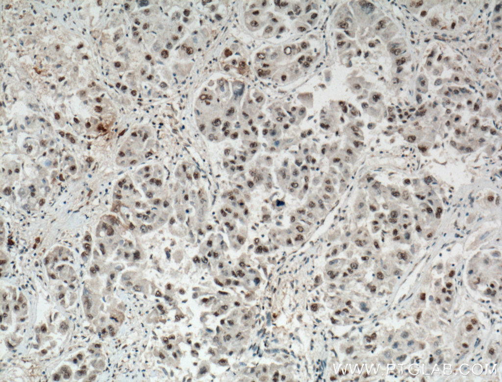 TAZ Monoclonal antibody