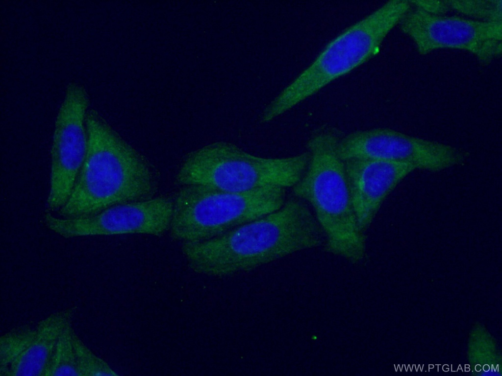 CNOT1 Monoclonal antibody