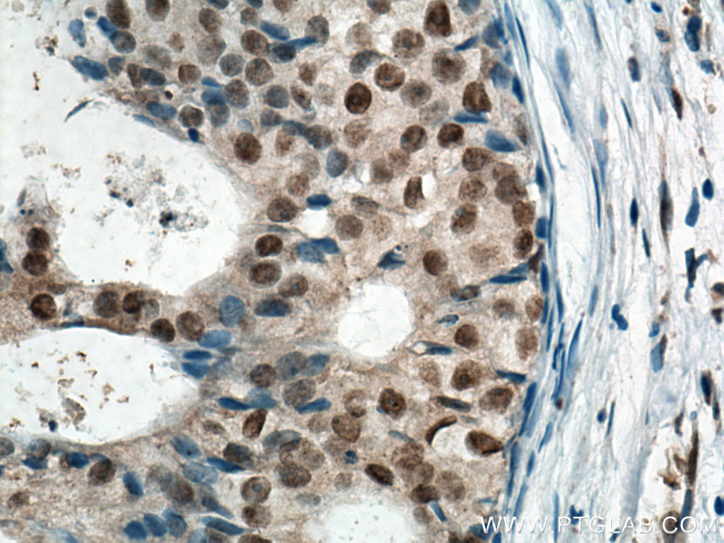 MDM2 Monoclonal antibody