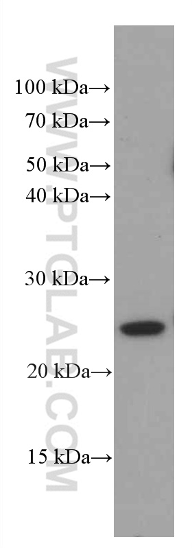 Recoverin Monoclonal antibody