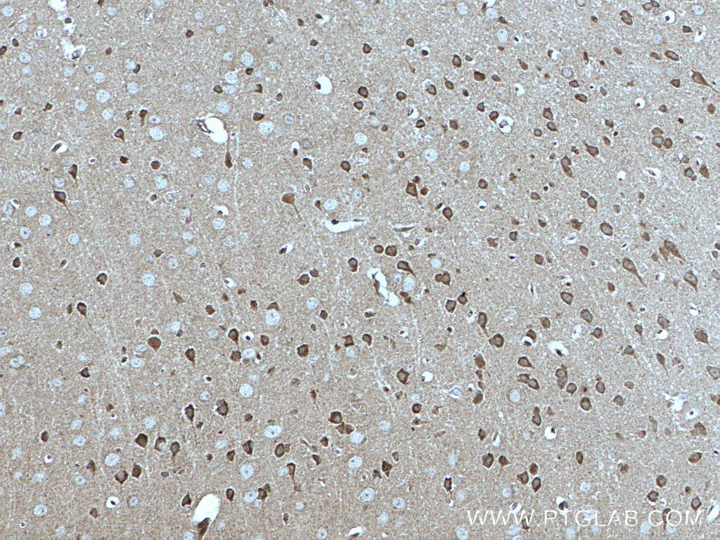 MFF Monoclonal antibody