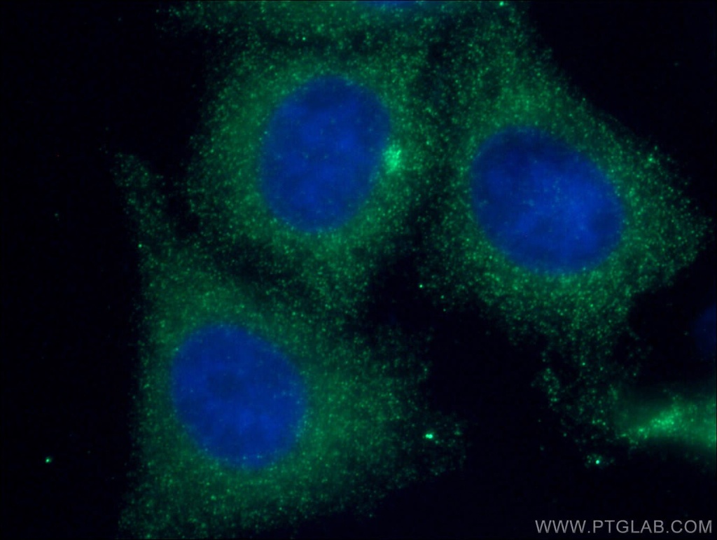 NF-κB p65 Monoclonal antibody