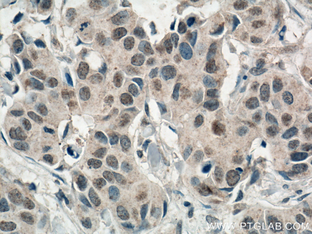 AMPK Alpha Monoclonal antibody