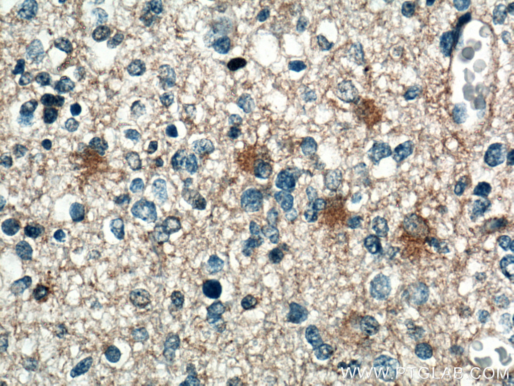 SEPT7 Monoclonal antibody