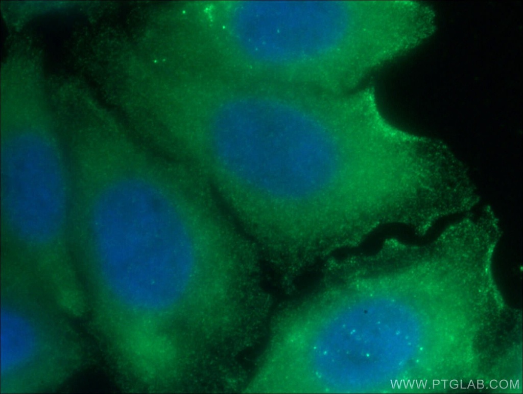 TWIST2 Monoclonal antibody